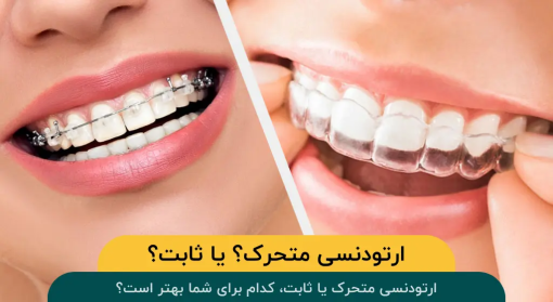 ارتودنسی-متحرک-یا-ثابت